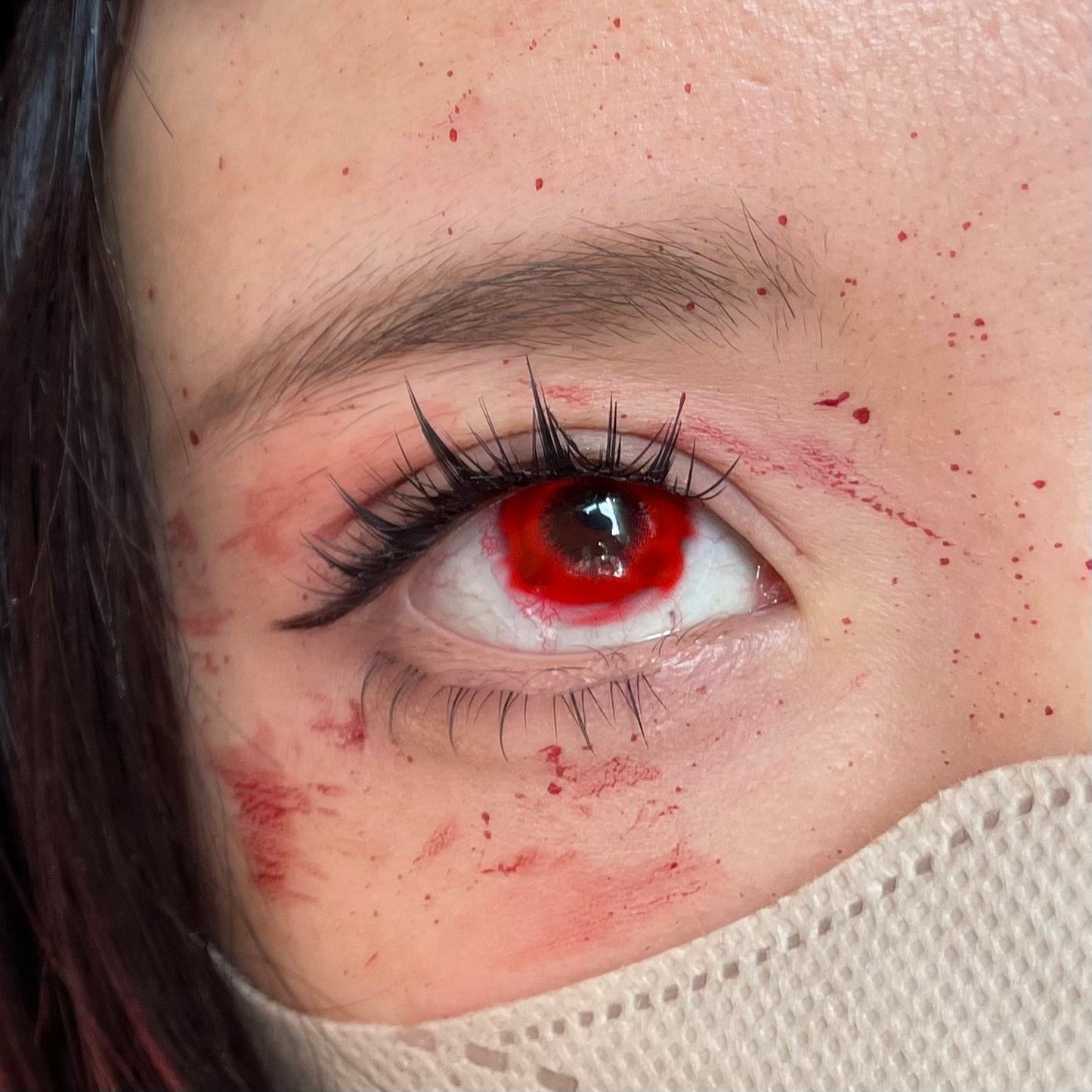 1-YEAR | CM | Pinkeye