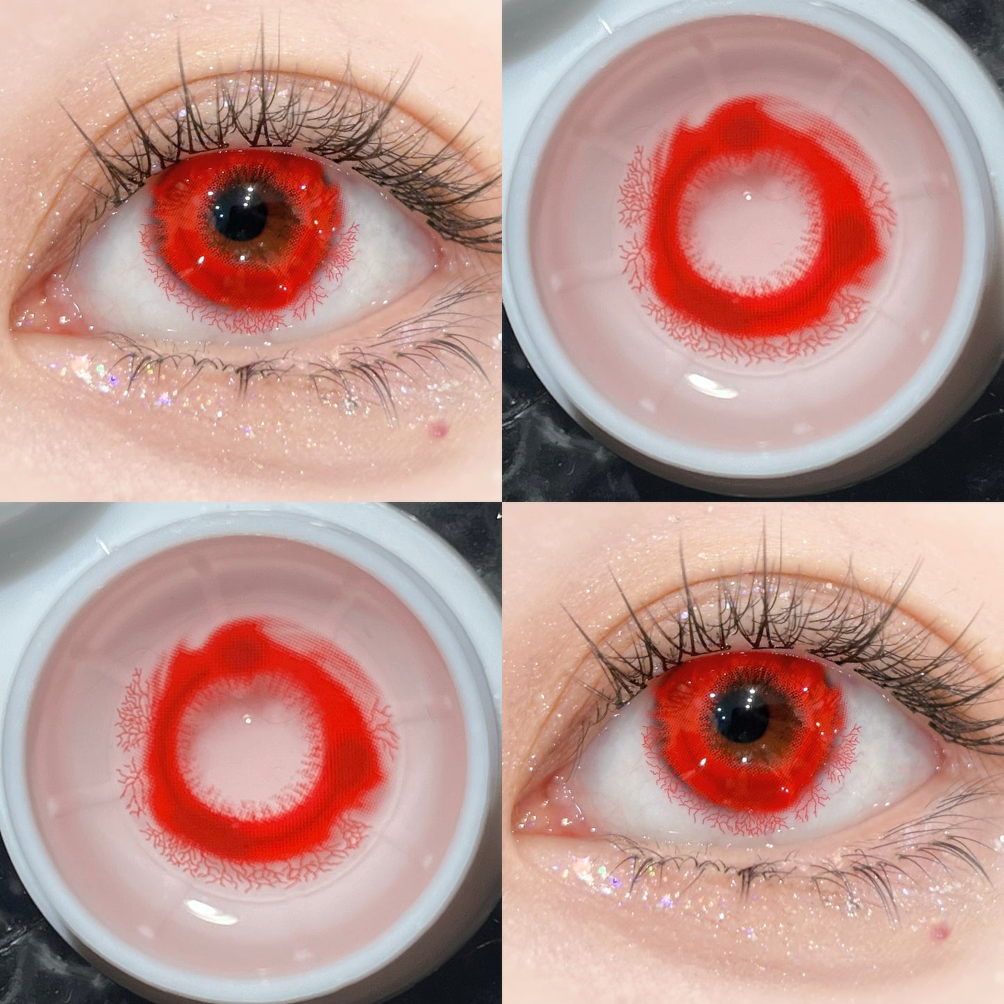 1-YEAR | CM | Pinkeye